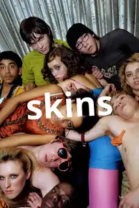 Skins (2007) - Serie TV Streaming HD